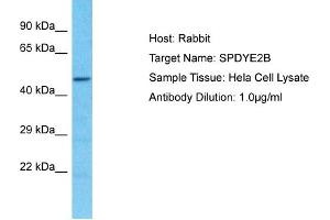 Host: Rabbit Target Name: SPDYE2B Sample Type: Hela Whole Cell lysates Antibody Dilution: 1. (SPDYE2B anticorps  (N-Term))