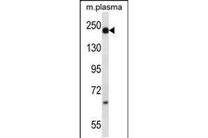 Western blot analysis in mouse plasma lysates (35ug/lane). (alpha 2 Macroglobulin anticorps  (N-Term))