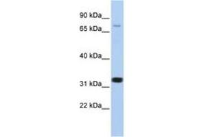 Image no. 1 for anti-Calcium Channel, Voltage-Dependent, beta 2 Subunit (CACNB2) (AA 21-70) antibody (ABIN6742718) (CACNB2 anticorps  (AA 21-70))