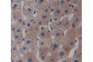 IHC-P analysis of Human Tissue, with DAB staining. (ADAM33 anticorps  (AA 210-503))