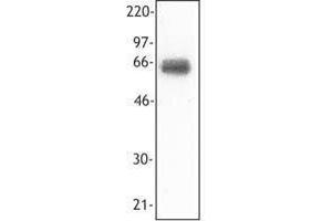 Western Blotting (WB) image for anti-Triggering Receptor Expressed On Myeloid Cells 1 (TREM1) antibody (ABIN2664607) (TREM1 anticorps)