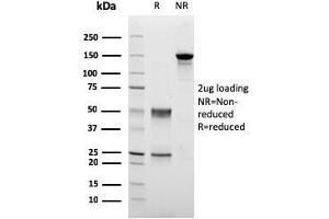 SDS-PAGE Analysis Purified PMEPA1 Mouse Monoclonal Antibody (PMEPA1/2698). (PMEPA1 anticorps)