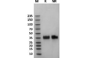 Human Fc gamma RIIa / CD32a (167H) protein on Coomassie Blue stained SDS-PAGE under non-reducing (NR) and reducing (R) conditions. (FCGR2A Protein (AA 36-218) (His-Avi Tag,Biotin))