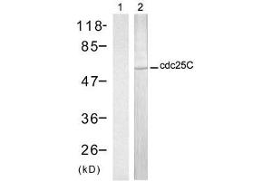 Western blot analysis of extract from HT-29 cells, using cdc25C (Ab-216) antibody (E021145, Lane 1 and 2). (CDC25C anticorps)
