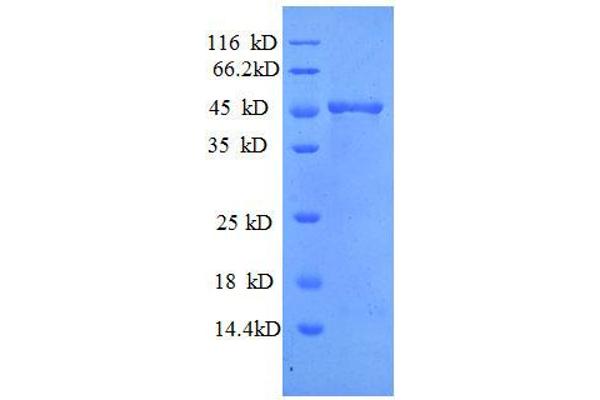 MMP7 Protein (AA 95-267, full length) (GST tag)