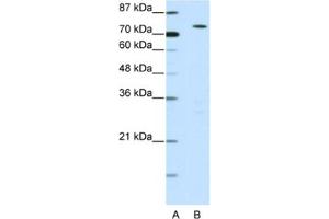 Western Blotting (WB) image for anti-MYST Histone Acetyltransferase 2 (MYST2) antibody (ABIN2460592) (MYST2 anticorps)
