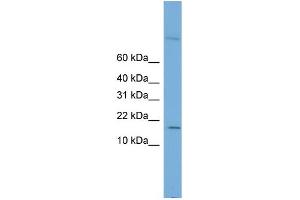 WB Suggested Anti-CST8 Antibody Titration: 0. (CST8 anticorps  (Middle Region))