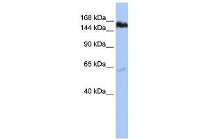 Western Blotting (WB) image for anti-Tankyrase, TRF1-Interacting Ankyrin-Related ADP-Ribose Polymerase (TNKS) antibody (ABIN2458044) (TNKS anticorps)