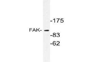 Western blot (WB) analyzes of FAK antibody in extracts from HT-29 cells. (FAK anticorps)