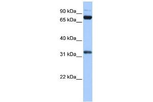 WB Suggested Anti-TAF6 Antibody Titration:  0. (TAF6 anticorps  (C-Term))
