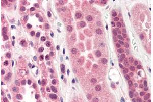 Human Kidney (formalin-fixed, paraffin-embedded) stained with STEAP1 antibody ABIN364397 at 10 ug/ml followed by biotinylated anti-mouse IgG secondary antibody ABIN481714, alkaline phosphatase-streptavidin and chromogen. (STEAP1 anticorps  (AA 1-70))