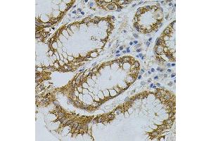Immunohistochemistry of paraffin-embedded human stomach using SIGMAR1 antibody. (SIGMAR1 anticorps)
