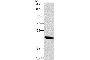 Western blot analysis of A172 cell, using BRS3 Polyclonal Antibody at dilution of 1:500 (BRS3 anticorps)