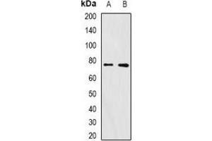 Western blot analysis of FURIN expression in A375 (A), mouse ovary (B) whole cell lysates. (FURIN anticorps)