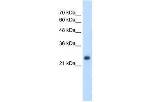 NNMT antibody used at 2. (NNMT anticorps  (N-Term))