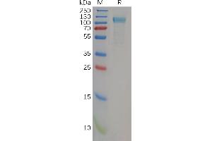 Human Protein, His Tag on SDS-PAGE under reducing condition. (TLR3 Protein (AA 28-80) (His tag))