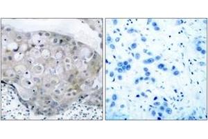 Immunohistochemistry (IHC) image for anti-VEGF Receptor 2 (VEGFR2) (pTyr951) antibody (ABIN2888557) (VEGFR2/CD309 anticorps  (pTyr951))