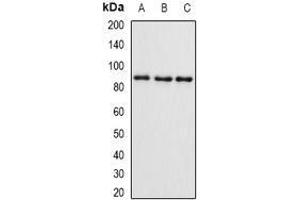 Western Blotting (WB) image for anti-SET and MYND Domain Containing 4 (SMYD4) (AA 1-260) antibody (ABIN5936313) (SMYD4 anticorps  (AA 1-260))