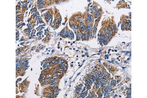 Immunohistochemistry (IHC) image for anti-Natriuretic Peptide A (NPPA) antibody (ABIN2422905) (NPPA anticorps)