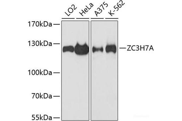 ZC3H7A anticorps
