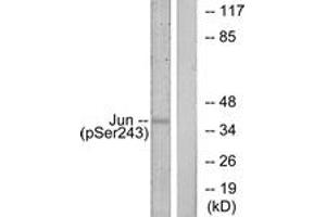 Western Blotting (WB) image for anti-Jun Proto-Oncogene (JUN) (pSer243) antibody (ABIN2888453) (C-JUN anticorps  (pSer243))