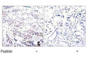 Image no. 1 for anti-ELK1, Member of ETS Oncogene Family (ELK1) (Ser383) antibody (ABIN197098) (ELK1 anticorps  (Ser383))