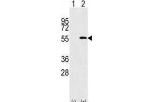 Western Blotting (WB) image for anti-Nucleoporin 50kDa (NUP50) antibody (ABIN2995223) (NUP50 anticorps)