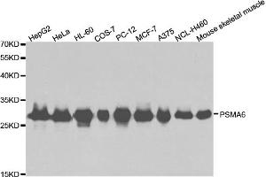 Western blot analysis of extracts of various cell lines, using PSMA6 antibody (ABIN5971214) at 1/1000 dilution. (PSMA6 anticorps)