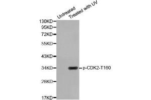 Western blot analysis of extracts from HeLa cells using Phospho-CDK2-T160 antibody (ABIN2987938). (CDK2 anticorps  (pThr160))