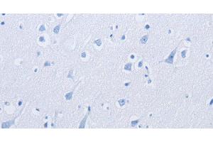 Immunohistochemistry of paraffin-embedded using KCNMB3 Polyclonal Antibody at dilution of 1: (KCNMB3 anticorps)