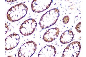 Immunohistochemistry of paraffin-embedded human colon using UCHL3 Rabbit mAb (ABIN1682628, ABIN3015461, ABIN3015462 and ABIN7101429) at dilution of 1:100 (40x lens). (UCHL3 anticorps)