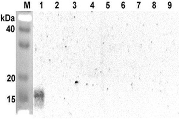 ANGPTL5 anticorps  (Coiled coil domain)