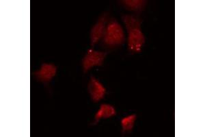 ABIN6267028 staining 293 by IF/ICC. (AKT1 anticorps  (C-Term))