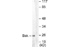 Western blot analysis of extracts from 293 cells, using Bak antibody (#C0131). (BAK1 anticorps)