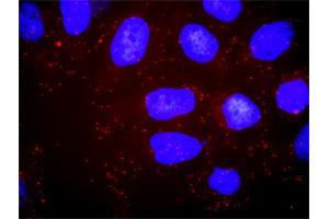 Proximity Ligation Assay (PLA) image for anti-Phosphoinositide 3 Kinase, p85 alpha (PI3K p85a) (AA 1-454) antibody (ABIN518903)