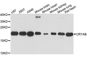 Western blot analysis of extracts of various cell lines, using CRYAB antibody. (CRYAB anticorps)