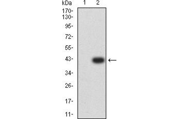 RIPK4 anticorps  (AA 675-784)