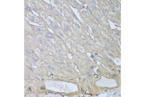 Immunohistochemistry of paraffin-embedded human liver using RPH3AL antibody. (RPH3AL anticorps  (AA 161-315))