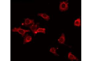 ABIN6268806 staining Hela by IF/ICC. (CD6 anticorps  (Internal Region))