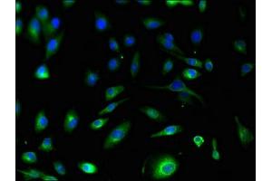 Immunofluorescent analysis of U251 cells using ABIN7166034 at dilution of 1:100 and Alexa Fluor 488-congugated AffiniPure Goat Anti-Rabbit IgG(H+L) (S1A1 (AA 2-97) anticorps)