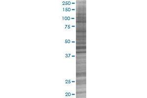 SMAD6 transfected lysate. (SMAD6 293T Cell Transient Overexpression Lysate(Denatured))