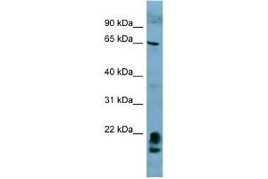 WB Suggested Anti-FAM134A Antibody Titration:  0. (FAM134A anticorps  (N-Term))