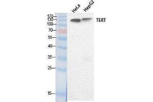 Western Blotting (WB) image for anti-Telomerase Reverse Transcriptase (TERT) (Internal Region) antibody (ABIN3178530) (TERT anticorps  (Internal Region))