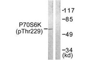 Western blot analysis of extracts from Jurkat cells, using p70 S6 Kinase (Phospho-Thr229) Antibody. (RPS6KB1 anticorps  (pThr229))