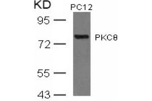 Image no. 3 for anti-Protein Kinase C, theta (PRKCQ) (AA 674-678) antibody (ABIN197567) (PKC theta anticorps  (AA 674-678))