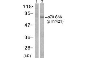 Western blot analysis of extracts from Jurkat cells, untreated or treated with GM-CSF (25ng/ml 30min) using p70 S6 Kinase (phospho-Thr421) antibody (E011254, Line 1 and 2). (RPS6KB1 anticorps  (pThr421))