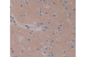 IHC-P analysis of brain tissue, with DAB staining. (ITPA anticorps  (AA 3-180))