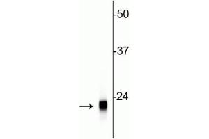 Western blot of rat cerebellar lysate showing specific immunolabeling of the ~22 kDa VSNL1 protein. (VSNL1 anticorps)