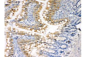 Immunohistochemistry (IHC) image for anti-Caspase 3 (CASP3) (AA 220-236), (C-Term) antibody (ABIN3044357)