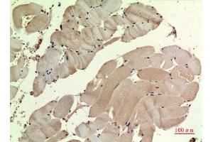 Immunohistochemistry (IHC) analysis of paraffin-embedded Human Muscle, antibody was diluted at 1:100. (SDHB anticorps  (Internal Region))